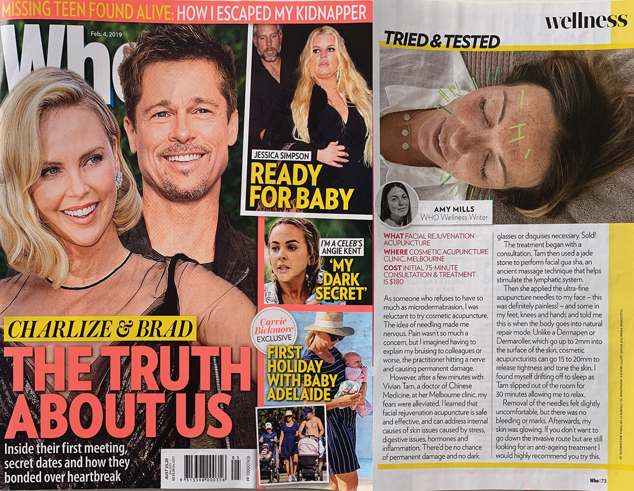 Tried & Tested Cosmetic Acupuncture – Who Magazine