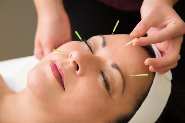 Everything you need to know about Cosmetic Acupuncture