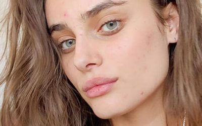 How to get your hormonal acne under control